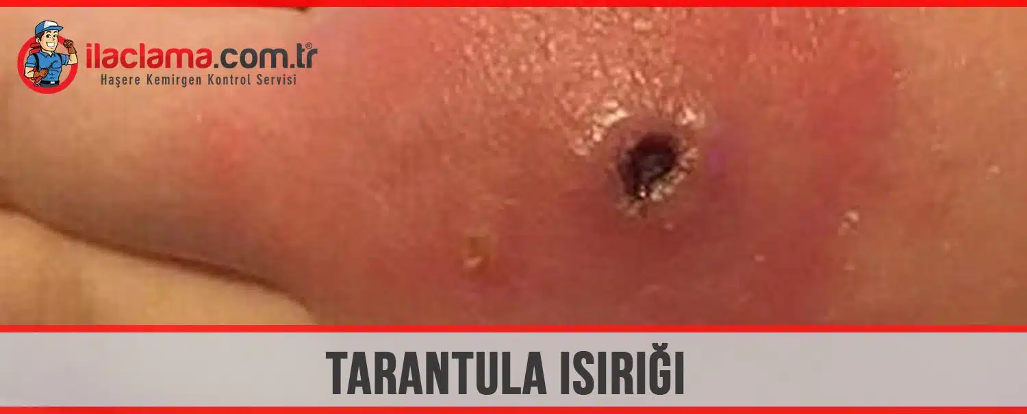 tarantula ısırığı