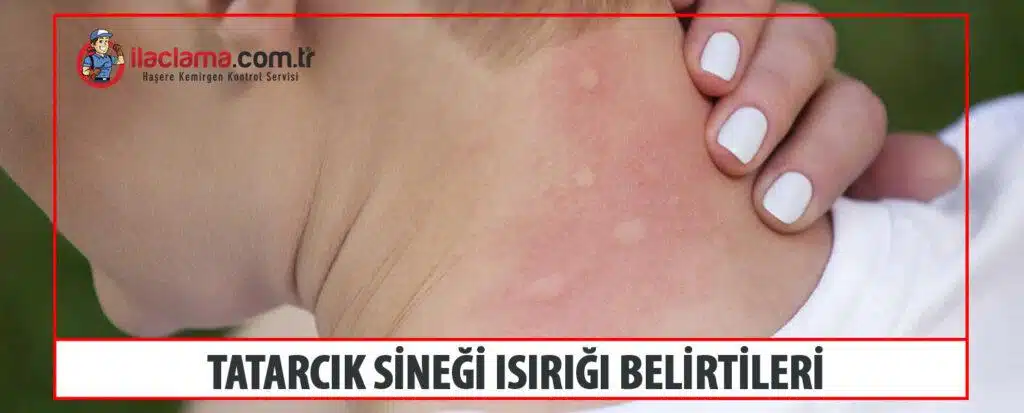 tatarcık ısırığı belirtileri